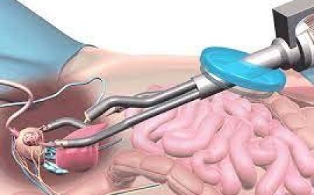 SMS में रोबोट करेगा कैंसर जैसी बीमारियों का फ्री इलाज:25-25 करोड़ की दो मशीनें खरीदीं