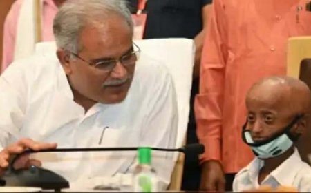 नहीं रहे छत्तीसगढ़ के 'पा': एक दिन के कलेक्टर शैलेंद्र का निधन; CM ने जताया दुख, कहा- भगवान उसका ख्याल रखें