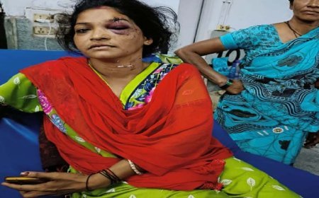 पति ने पत्नी पर चाकू से 11 बार किया हमला:शराब के नशे में पति ने मारा चाकू, भाग कर बचाई जान, चेहरे और गर्दन में आई चोंट