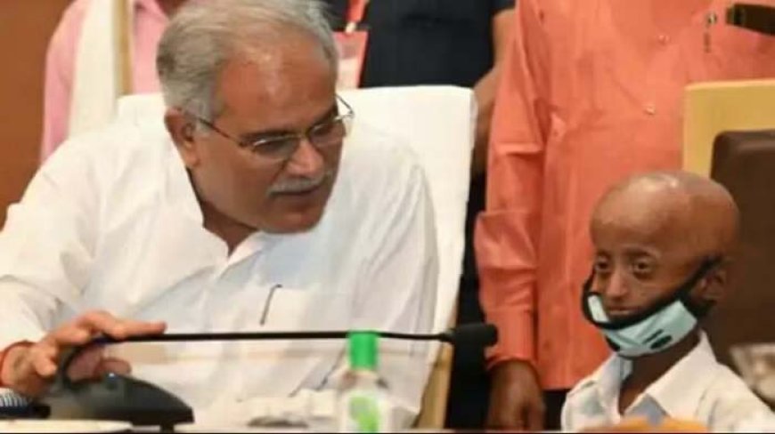 नहीं रहे छत्तीसगढ़ के 'पा': एक दिन के कलेक्टर शैलेंद्र का निधन; CM ने जताया दुख, कहा- भगवान उसका ख्याल रखें