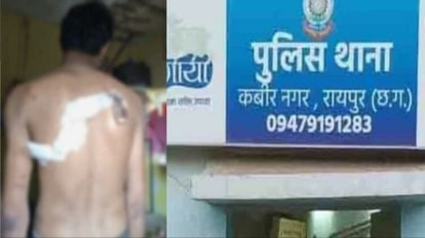 रायपुर में फिर चाकूबाजी: बेलगाम बदमाश, दिनदहाड़े ऑटो ड्राइवर पर किया चाकू से ताबड़तोड़ हमला, मौके से फरार