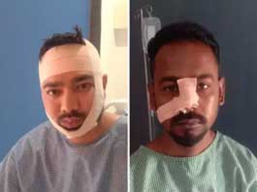BJYM अध्यक्ष पर धारदार हथियार से हमला:होटल में हंगामा कर रहे थे बदमाश, समझाने पर मारी रॉड और भाग गए