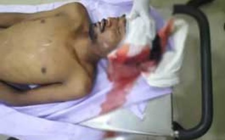 रक्षाबंधन के दिन बहन-भांजे की बीमारी से मौत:सदमें में आकर मामा ने भी हॉस्पिटल के दूसरे मंजिल से कूदकर कर ली आत्महत्या