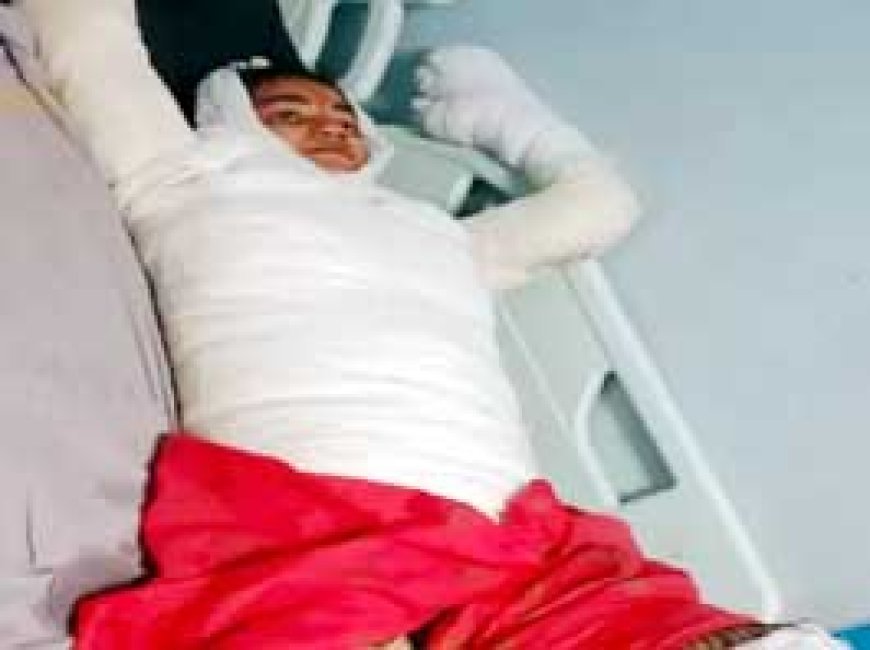 ब्रेकिंग न्यूज : गर्लफ्रेंड को जिंदा जलाया, शादी करने से मना किया तो नाराज हुआ बॉयफ्रेंड, हालत गंभीर