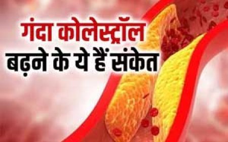 5 संकेत बताते हैं कि आपके हार्ट के आस-पास मंडराने लगा है घटिया कोलेस्ट्रॉल, यही है संभलने का मौका, वरना हार्ट अटैक का हो सकता है हमला