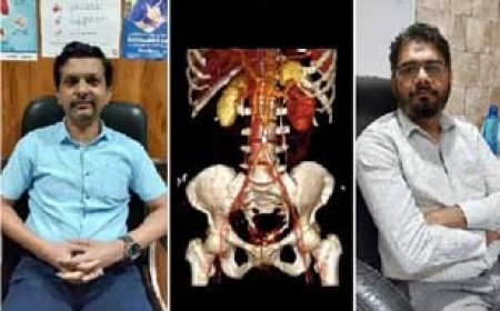 भिलाई में 55 वर्षीय महिला में थी 3 किडनी, चार सर्जरी के बाद भी पता नहीं चला, फिर डॉक्टरों ने किया यह कमाल