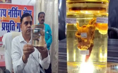 खास खबर : छत्तीसगढ़ में युवक के पेट से निकला गर्भाशय....धमतरी में फैलोपियन ट्यूब को भी सर्जरी कर निकाला गया