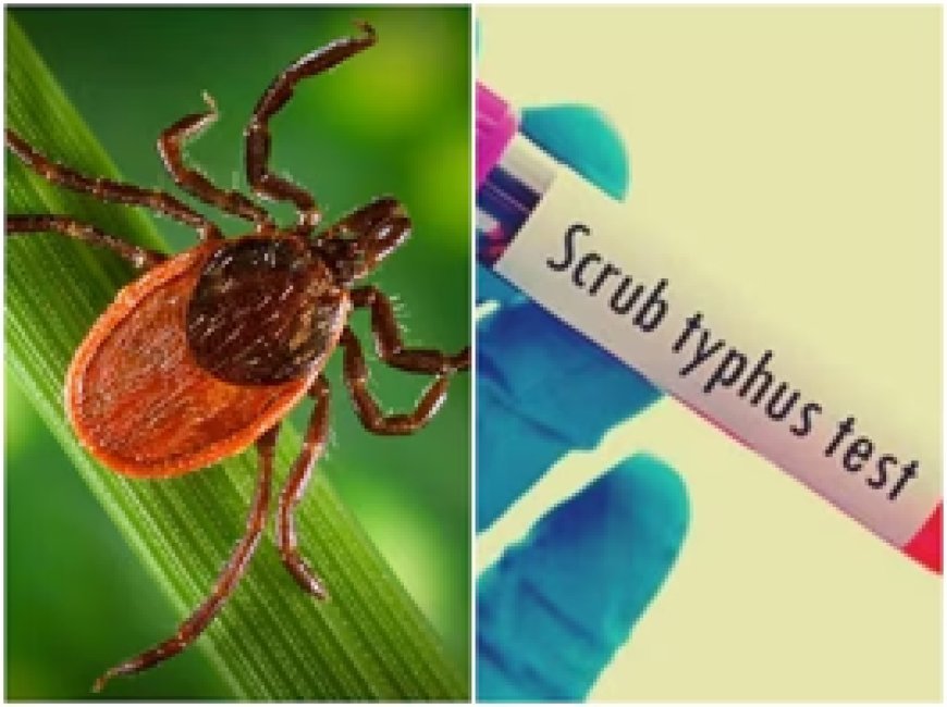 स्क्रब टाइफस क्या है? रहस्यमयी बुखार के कई राज्यों में बढ़ रहे केस, क्या हैं लक्षण और इलाज