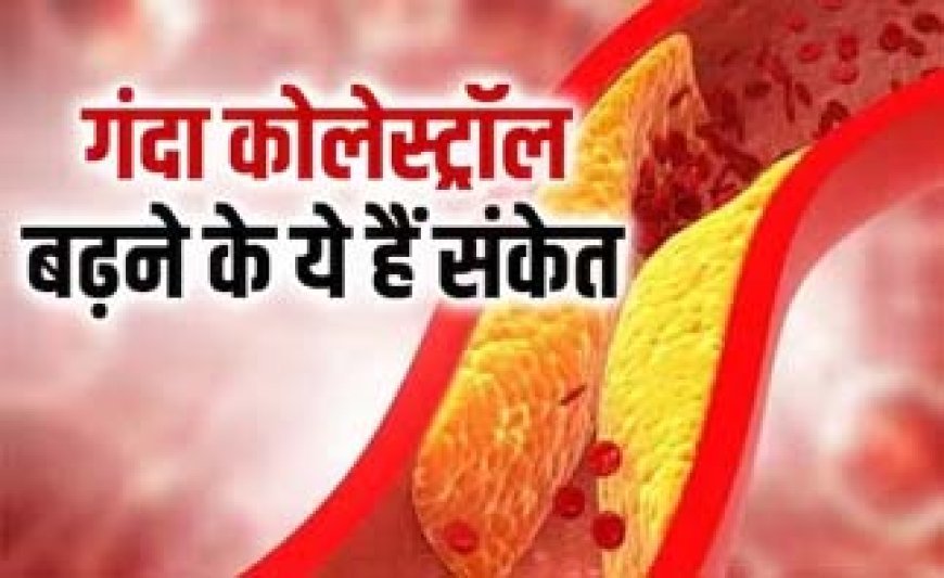 शरीर को भारी नुकसान पहुंचाने लगता है हाई कोलेस्ट्रॉल, साइलेंट किलर है यह बीमारी, चौकन्ना रहेंगे तो फायदे में रहेंगे