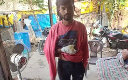 कटा हाथ लेकर थाने के चक्कर काट रहा मजदूर:कंपनी में पहले बिना सुरक्षा मानक के काम कराया, दुर्घटना होने पर फैक्ट्री से भगाया