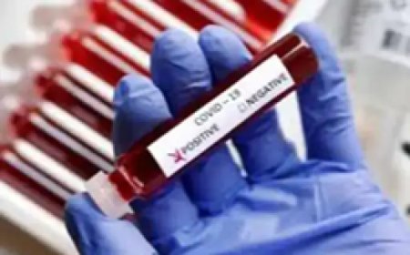 ब्रेकिंग न्यूज : कोरोना के नए वैरिएंट को लेकर छत्तीसगढ़ में अलर्ट:सभी जिलों में जांच बढ़ाने के आदेश...