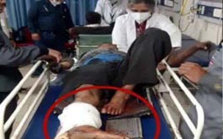 भिलाई स्टील प्लांट में रोलर में फंसा मजदूर:रोलर टेबल में मेंटेनेस का चल रहा था काम, गंभीर हालत में सेक्टर-9 हॉस्पिटल रेफर