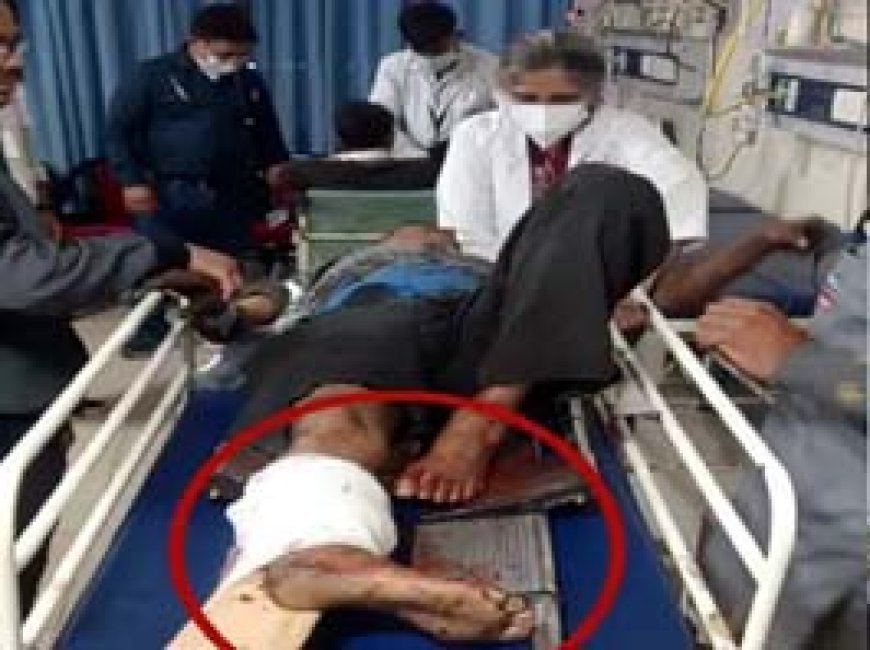 भिलाई स्टील प्लांट में रोलर में फंसा मजदूर:रोलर टेबल में मेंटेनेस का चल रहा था काम, गंभीर हालत में सेक्टर-9 हॉस्पिटल रेफर