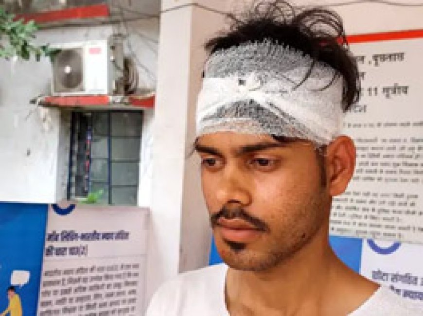 रुपए नहीं दिए तो पेट्रोल पंपकर्मी का सिर फोड़ा...दुर्ग में ग्लास तोड़कर कैश रूम में घुसे बदमाश....