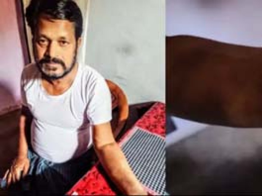 दुर्ग में रेलवे कर्मी से मारपीट और लूट:खुर्सीपार थाना के सामने बदमाशों ने पीटा