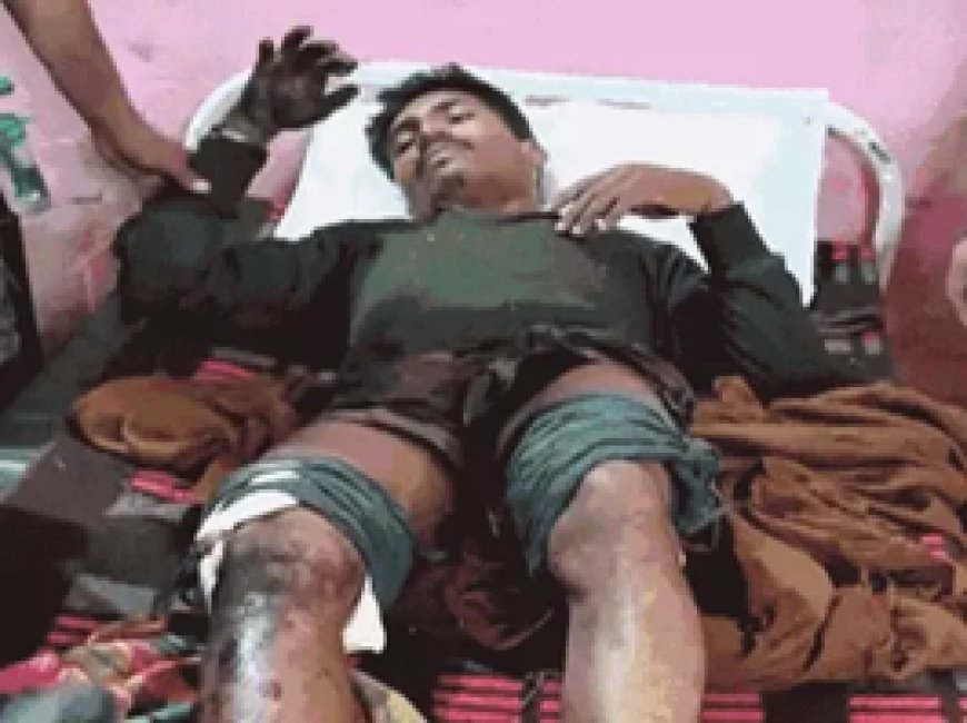 दंतेवाड़ा-बीजापुर बॉर्डर में IED ब्लास्ट, 2 जवान जख्मी:एक की हालत गंभीर, रायपुर रेफर; एनकाउंटर में 2 नक्सली ढेर, शव बरामद