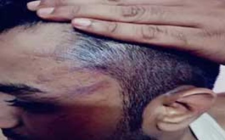 बैंककर्मी ने पुलिसवालों पर पिटाई करने का लगाया आरोप....दुर्ग में पति-पत्नी का झगड़ा शांत कराने पहुंची पुलिस, फिर पति को थाने में जमकर कूटा