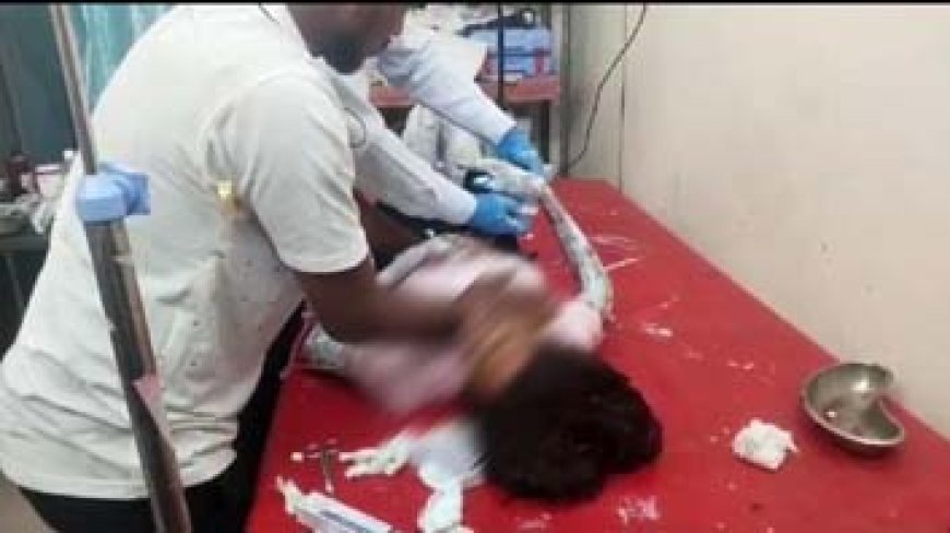 HERO इलेक्ट्रिक स्कूटर ब्लास्ट मामला: चार्जिंग के दौरान हुआ था विस्फोट, बुरी तरह घायल हो गई थी युवती, अस्पताल में इलाज के दौरान मौत