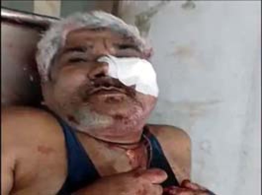 दुर्ग में दामाद ने ससुर पर एयरगन से किया हमला...आंख के नीचे लगा छर्रा, बेटी को लेने आया था ससुराल....