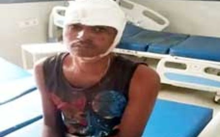 'कोई काम नहीं करता, इधर-उधर घूमता रहता है'.....दुर्ग में काम करने बोला तो बड़े भाई का फोड़ा सिर