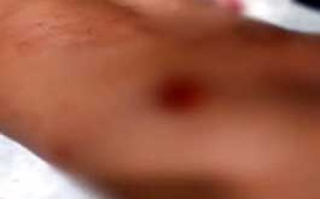 सगे भाइयों ने फूफा के लड़के को चाकू से मारा.......रायपुर में युवक गंभीर हालत में अस्पताल में भर्ती,