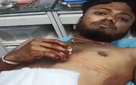 आपसी रंजिश में 2 भाइयों को मारा चाकू,आंतें निकली बाहर......दुर्ग पुलिस ने देर रात की छापेमारी,  4 आरोपियों को किया गिरफ्तार