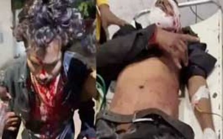 2 भाइयों को मारा चाकू,फिर खुर्सीपार में तलवार से हमला....दुर्ग जिले में बढ़ी चाकूबाजी की वारदातें....