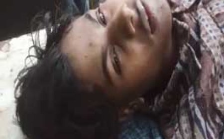 नाबालिग को कटर से मारा...सिर और गले में चोट, गंभीर हालत में अस्पताल में भर्ती