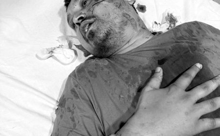 ब्रेकिंग न्यूज : रायपुर जेल में गैंगवार का तूफ़ान: पूर्व सीएम के करीबी आशीष शिंदे पर जानलेवा हमला