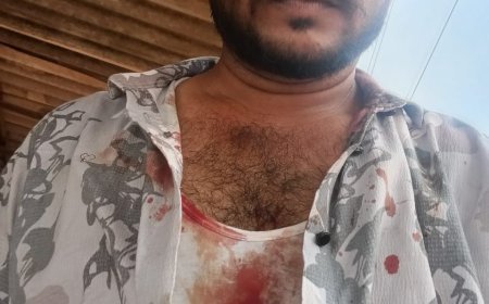 उचित मूल्य दुकान के ताले से ड्राइवर पर हमला, सिर फटा