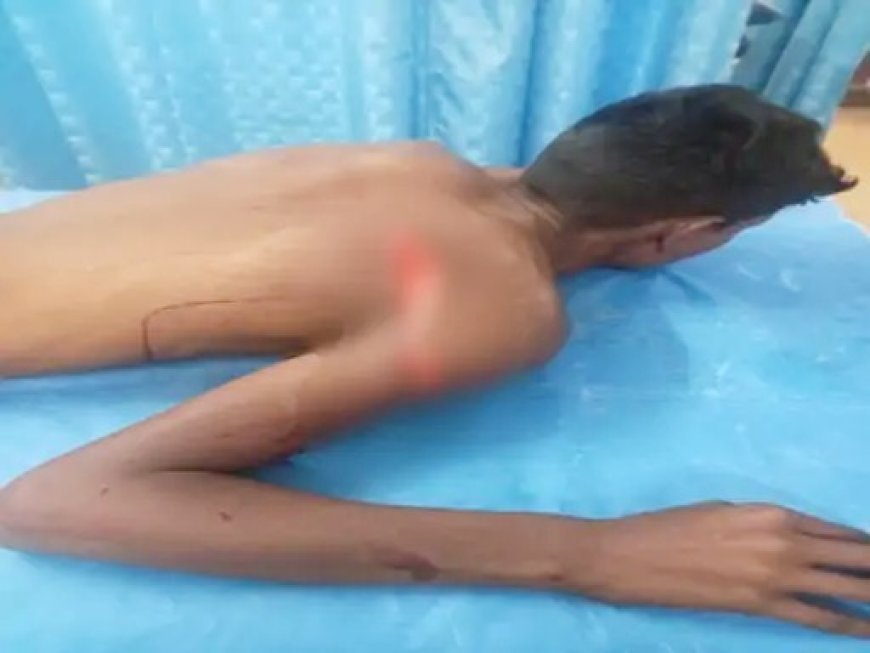 भिलाई के स्कूल में छात्र पर कटर से हमला: 28 टांके लगे, परिजनों का हंगामा