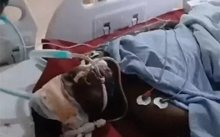 रायपुर में विदेशी छात्र की संदेहास्पद मौत: निजी यूनिवर्सिटी की चौथी मंजिल से गिरा, गर्लफ्रेंड-बॉयफ्रेंड पर हत्या का आरोप, 4 गिरफ्तार