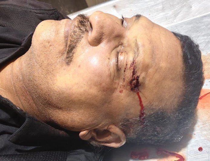 बस से उतरते ही गिरे महिला थाना के प्रधान आरक्षक, अस्पताल में डॉक्टरों ने किया मृत घोषित