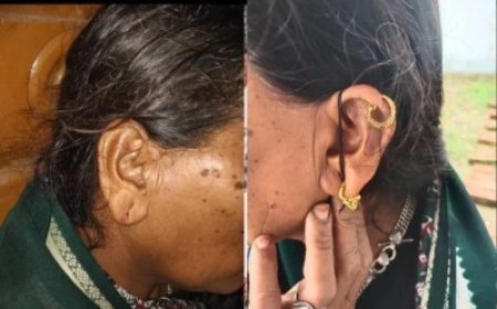 सोती रही महिला, चोर कान से सोना नोचकर भागा… मुंगेली के एक ही घर में 4 महीने में दूसरी चोरी