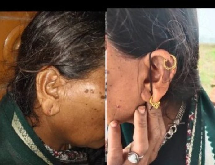 सोती रही महिला, चोर कान से सोना नोचकर भागा… मुंगेली के एक ही घर में 4 महीने में दूसरी चोरी