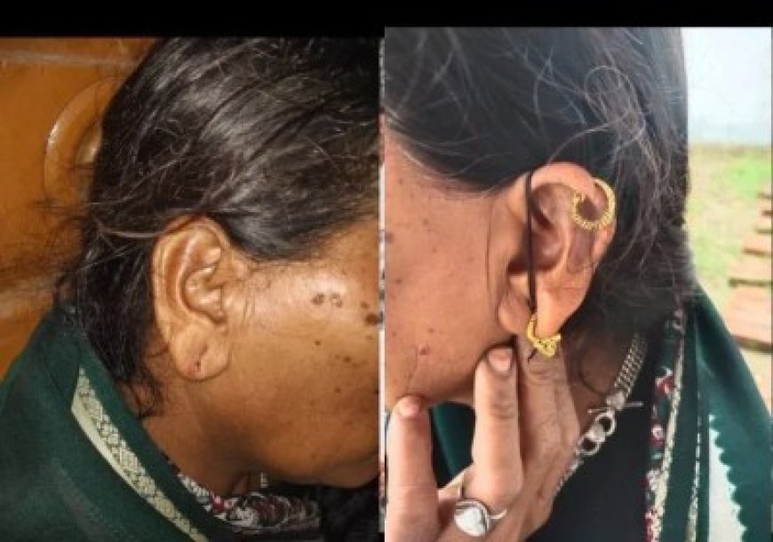 सोती रही महिला, चोर कान से सोना नोचकर भागा… मुंगेली के एक ही घर में 4 महीने में दूसरी चोरी