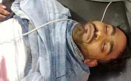 नेहरू नगर में मामूली कहासुनी बनी जानलेवा, युवक पर चाकू से हमला; अस्पताल में मौत